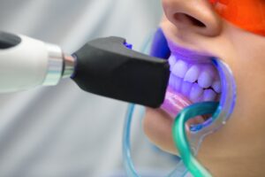 چرا بلیچینگ دندان همیشه نتیجه یکسانی نمی‌دهد؟